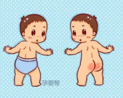 夏天穿紙尿褲真的會紅屁股嗎？